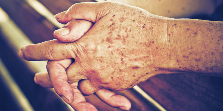 En finir avec les taches brunes